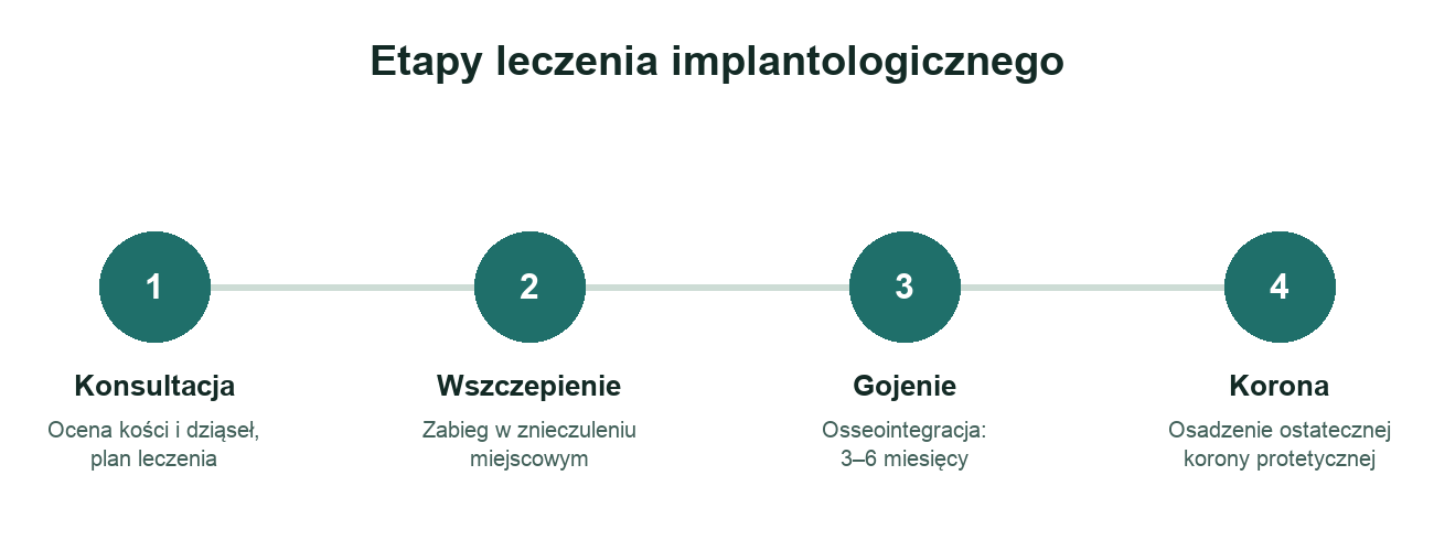 Cztery etapy leczenia implantologicznego: konsultacja, wszczepienie, gojenie, korona