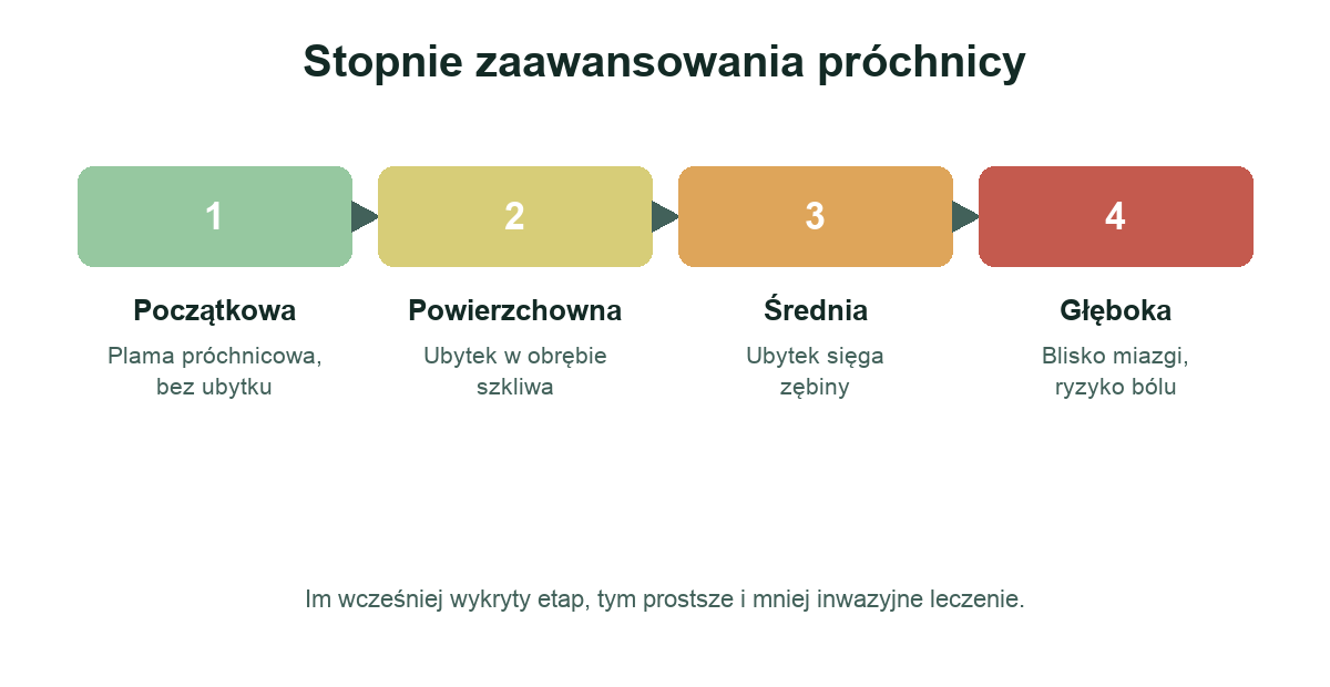 Cztery stopnie zaawansowania próchnicy zębów od początkowej do głębokiej